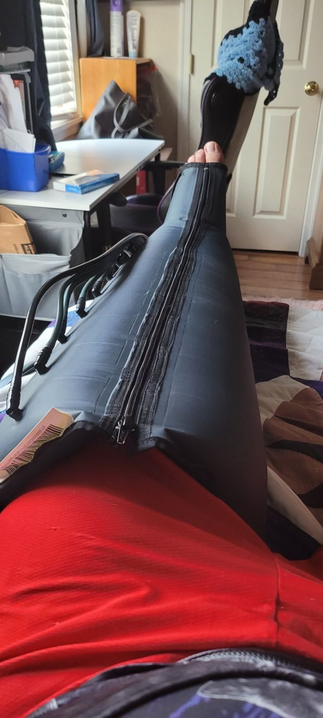 Michael's left leg in a pneumatic compression pump sleeve at home