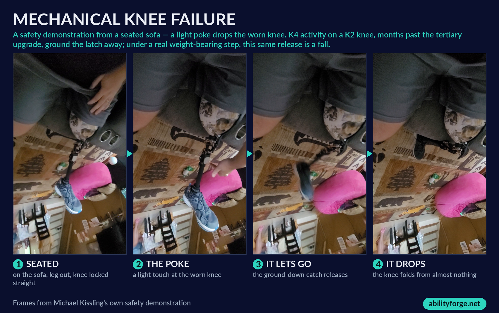Four-frame sequence of a mechanical prosthetic knee failing: standing, a light poke at the knee, the worn latch releasing, and the knee buckling into a fall.